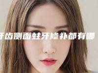 牙齿侧面蛀牙修补都有哪些人