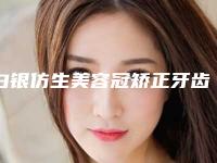 白银仿生美容冠矫正牙齿术对人体副作用有哪些