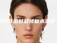 红河牙齿柱冠修复术会影响工作吗