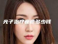 光子治疗痤疮多少钱