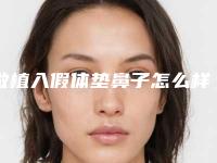 做植入假体垫鼻子怎么样