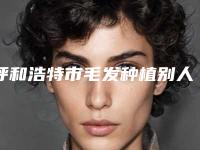 呼和浩特市毛发种植别人比较好医院(内蒙古医科大学附属医院实力口碑一一盘点)