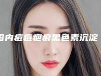 国内痘痘疤痕黑色素沉淀去除医院哪家好：痘痘疤痕黑色素沉淀去除医院前50名单更新了