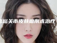 嘉峪关市皮肤磨削术治疗雀斑收费明细2025表同步上线(近6个月均价为：1772元)