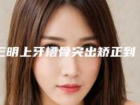 三明上牙槽骨突出矫正到哪家整形效果好