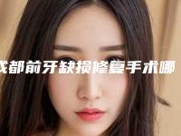 成都前牙缺损修复手术哪里比较便宜