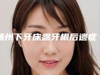 扬州下牙床露牙根后遗症会有哪些呢