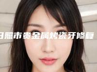 日照市贵金属烤瓷牙修复医院排行前十位可靠榜单发布（日照市贵金属烤瓷牙修复口腔医院口碑实力均在线）