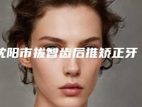 沈阳市拔智齿后推矫正牙齿医院排名榜专家-技术pk（沈阳众新口腔诊疗中心收获好评排榜一）