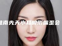 淮南先天小耳畸形嘴歪会不会影响工作生活