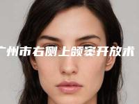 广州市右侧上颌窦开放术医院排行前十名种草一览（广州市右侧上颌窦开放术口腔医院实力口碑都很牛）