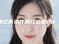 通辽市治疗鲜红斑痣2025价格(费用)在线咨询(近6个月均价为：5255元)