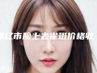 通辽市脸上去雀斑价格收费表在线免费公布-通辽市脸上去雀斑手术一般价位多少钱