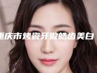 重庆市烤瓷牙做皓齿美白多少钱-重庆市烤瓷牙做皓齿美白医院在榜名单资质_实力_医疗技术PK