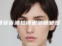 西安音波拉皮面部除皱多少钱呢？