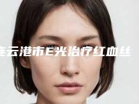 连云港市E光治疗红血丝价格表(费用)一览新板(E光治疗红血丝均价为：3875元)