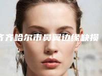 齐齐哈尔市鼻翼边缘缺损收费明细2025全面曝光(近6个月均价为：30561元)